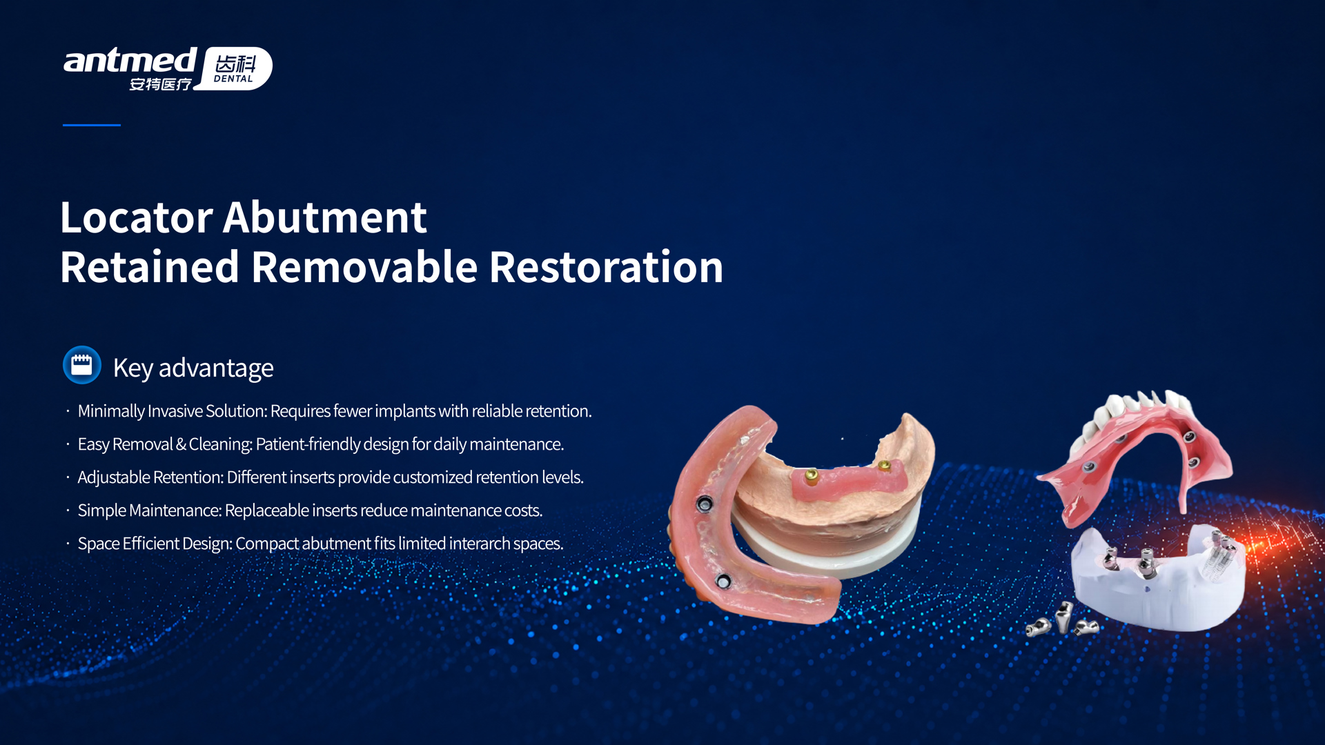 Locator Abutment Retained Removable Restoration