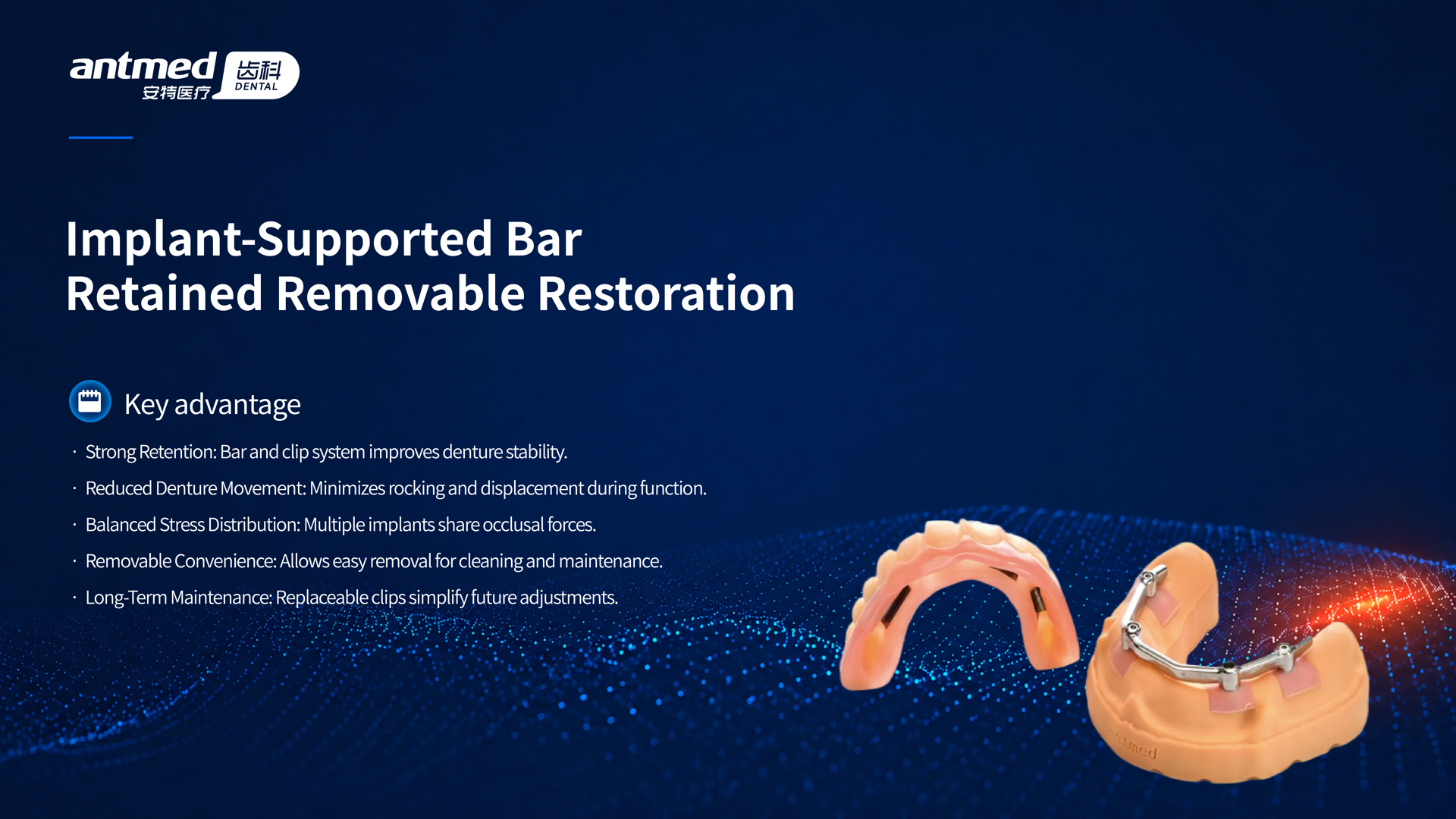 Implant-Supported Bar Retained Removable Restoration