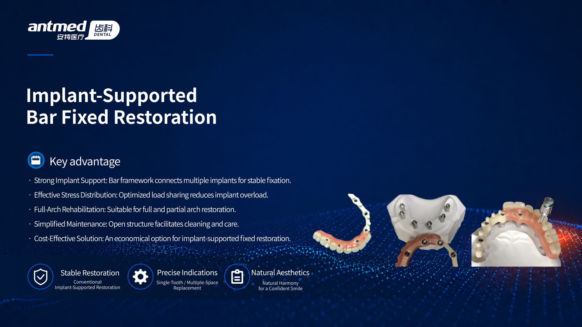 Implant-Supported Bar Fixed Restoration