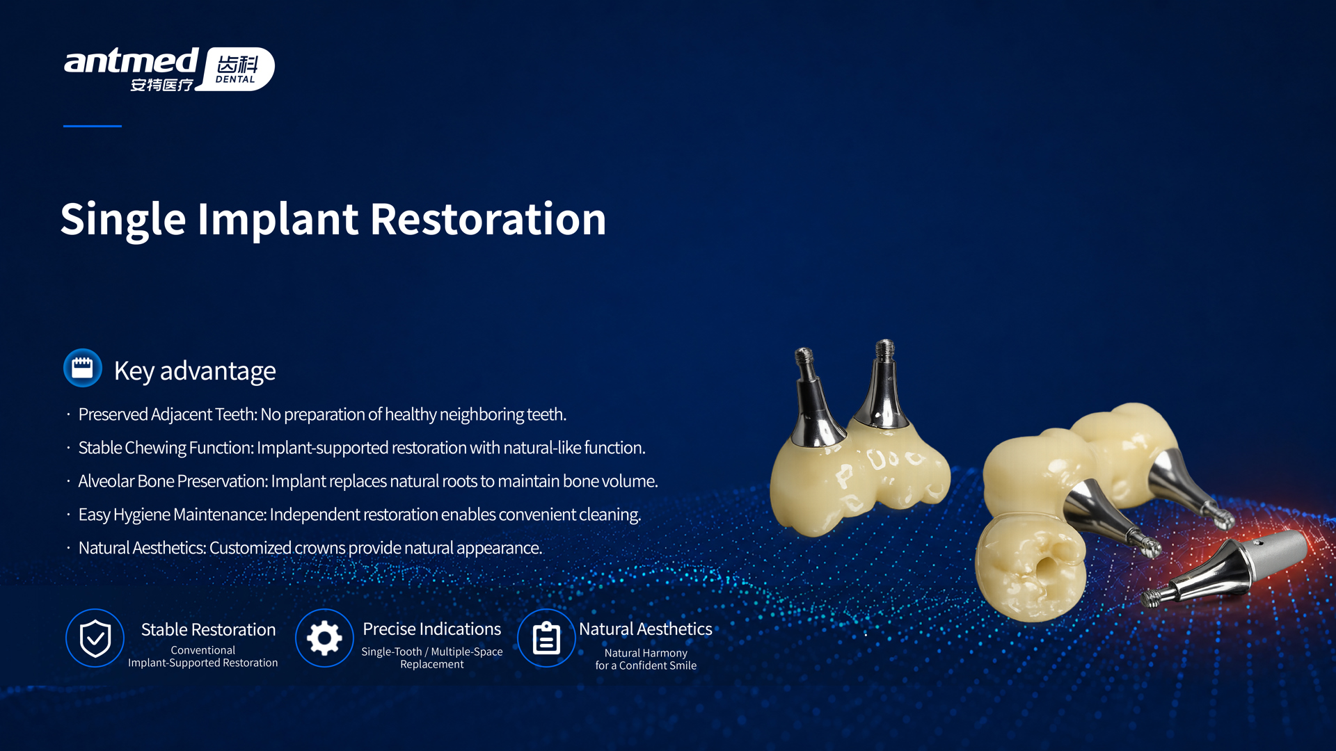 Single Implant Restoration