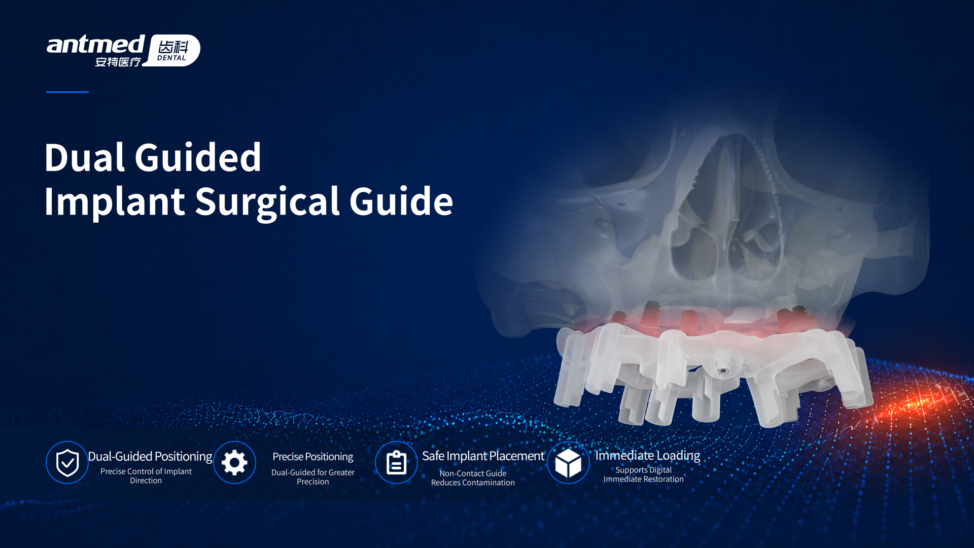 Dual Guided Implant Surgical Guide